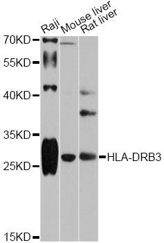 Western blot - HLA-DRB3 antibody (144-012444)