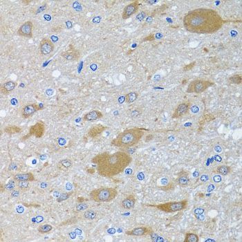 Immunohistochemistry - EIF2S3 antibody (144-06581)