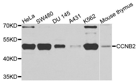 Western blot - CCNB2 antibody (144-03351)