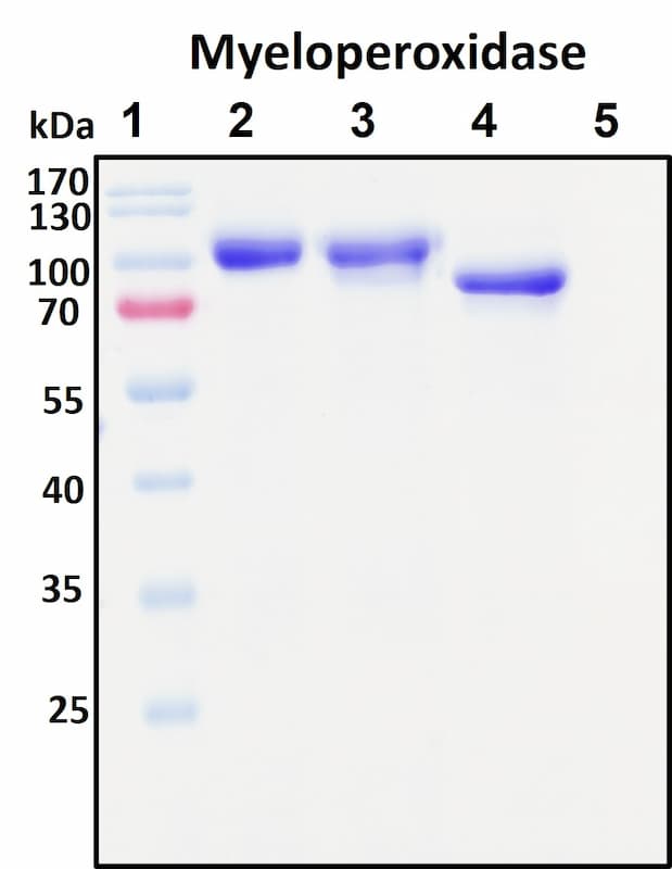 SDS-PAGE