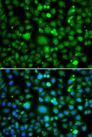 Immunofluorescence - TEK antibody (144-07222)