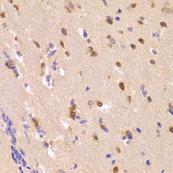 Immunohistochemistry - ROCK2 Polyclonal Antibody (144-05698)