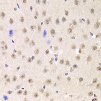 Immunohistochemistry - PRPF3 Polyclonal Antibody (144-05482)