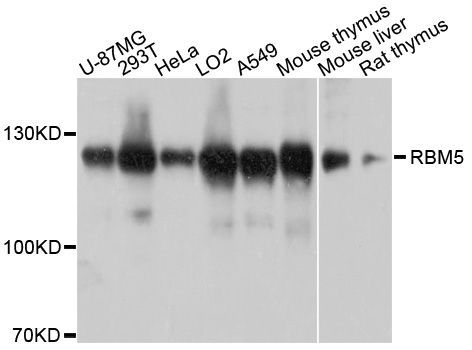 Western blot - RBM5 Polyclonal Antibody (144-10788)