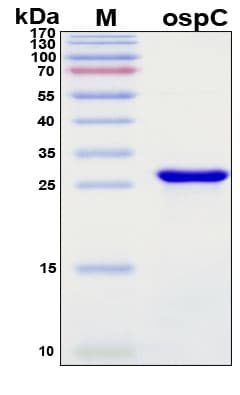 SDS-PAGE Image