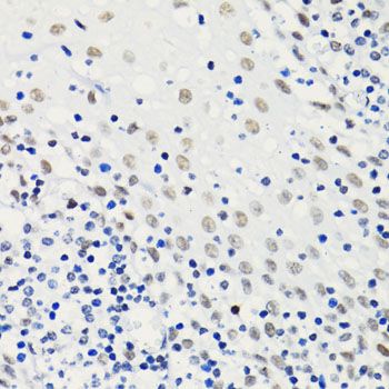 Immunohistochemistry - Acetyl-Histone H4-K5 pAb (144-60957)