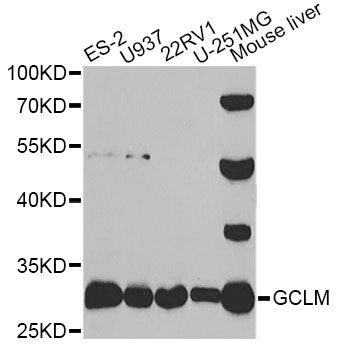 Western blot - GCLM antibody (144-05314)