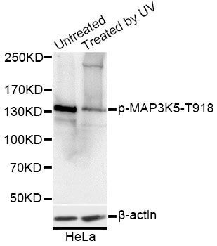 Western blot - Phospho-MAP3K5-T918 antibody (144-50061)
