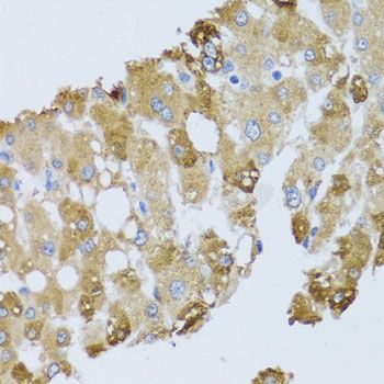 Immunohistochemistry - BNIP3 Polyclonal Antibody (144-05683)