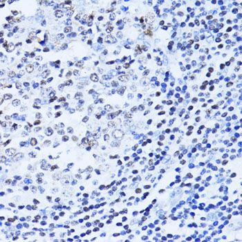 Immunohistochemistry - PARP1 Polyclonal Antibody (144-00942)