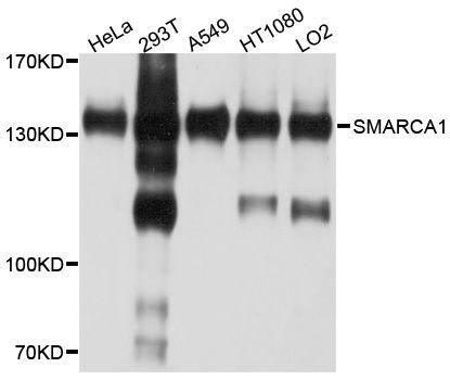 Western blot - SMARCA1 Polyclonal Antibody (144-010248)