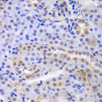 Immunohistochemistry - PSMA6 Polyclonal Antibody (144-60381)