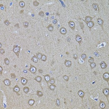 Immunohistochemistry - PHF1 antibody (144-08450)