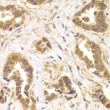 Immunohistochemistry - ROCK2 Polyclonal Antibody (144-05698)