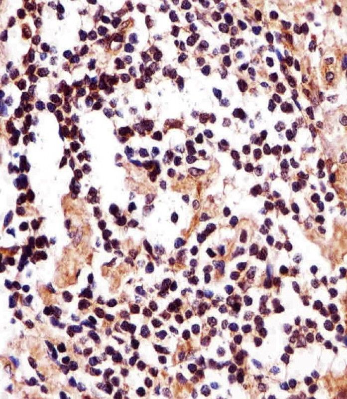 IHC-P