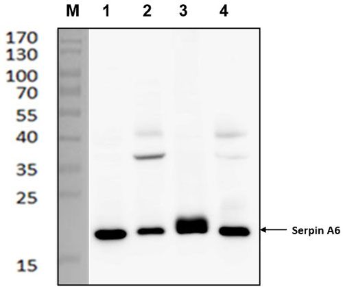 Western blot image