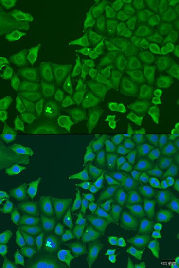 Immunofluorescence - ABCF2 antibody (144-012555)