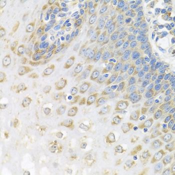 Immunohistochemistry - PABPC4 antibody (144-05948)