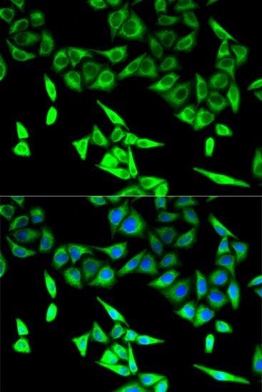 Western blot - [KO Validated] HADHA Polyclonal Antibody (144-05346)