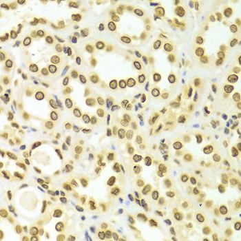 Immunohistochemistry - Lamin A/C Polyclonal Antibody (144-00249)