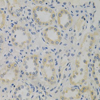 Western blot - STMN1 Polyclonal Antibody (144-014018)