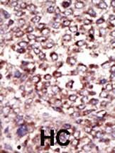 IHC-P