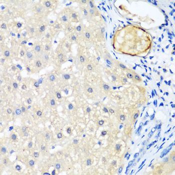 Immunohistochemistry - LRP5 Polyclonal Antibody (144-00130)