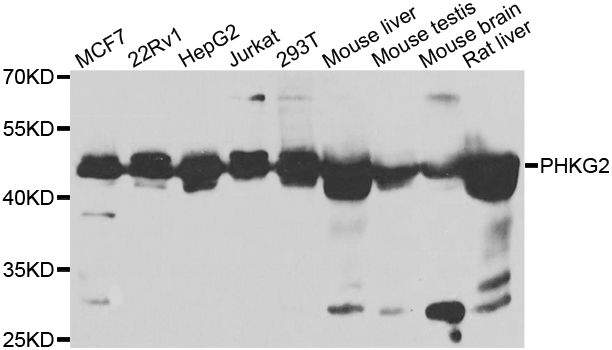 Western blot - PHKG2 antibody (144-60561)