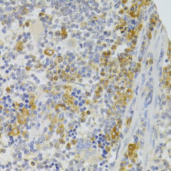 Immunohistochemistry - TRAF3IP2 Antibody (144-06776)