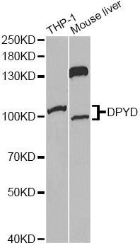 Western blot - DPYD Antibody (144-01620)