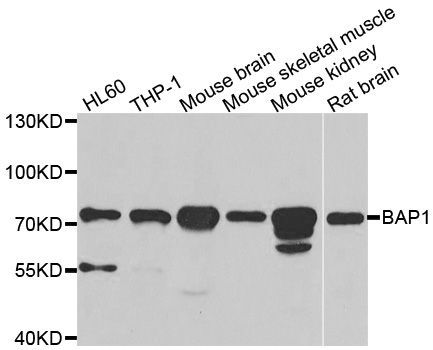 Immunohistochemistry - BAP1 Polyclonal Antibody (144-06533)
