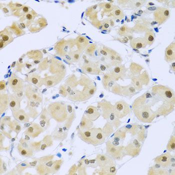 Immunohistochemistry - SMEK1 Polyclonal Antibody (144-08500)