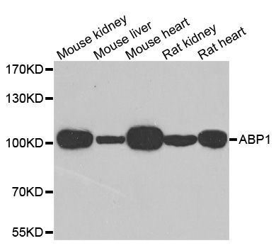 Western blot - AOC1 Polyclonal Antibody (144-06249)