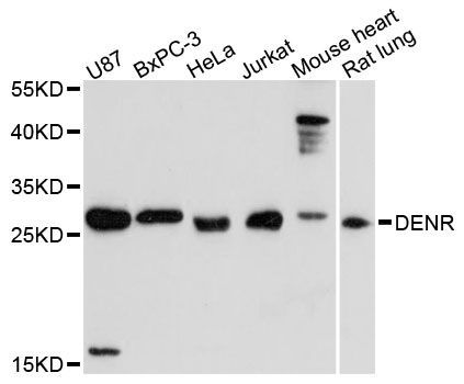 Western blot - DENR antibody (144-60452)