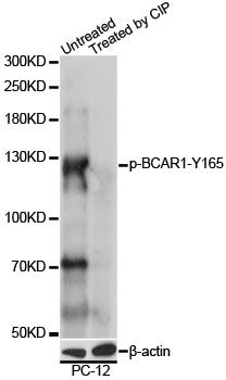 Western blot - Phospho-BCAR1-Y165 pAb (144-61532)