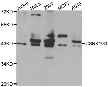 Western blot - CSNK1G1 antibody (144-07510)