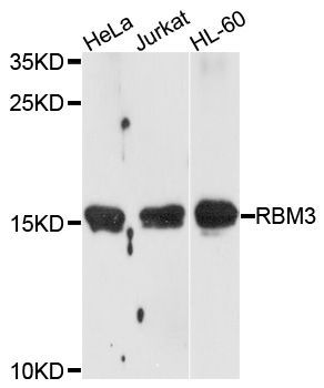 Western blot - RBM3 Polyclonal Antibody (144-05931)