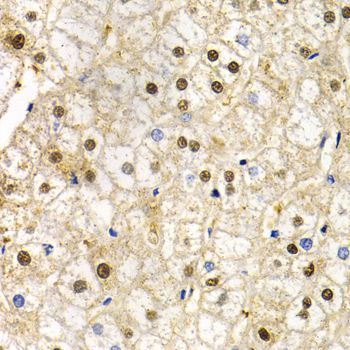 Immunohistochemistry - RAD9A Polyclonal Antibody (144-01890)