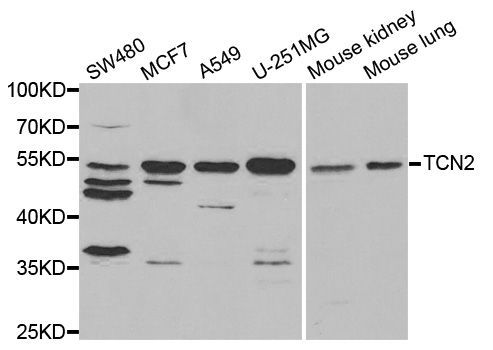 Western blot - TCN2 Polyclonal Antibody (144-05755)