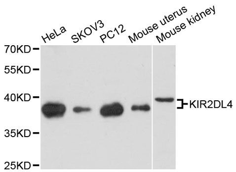 Western blot - KIR2DL4 antibody (144-12836)