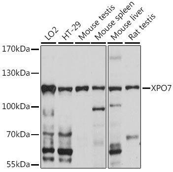 Western blot