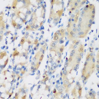 Immunohistochemistry - RRM1 Polyclonal Antibody (144-01152)