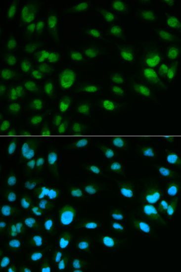 Immunofluorescence - MCM7 antibody (144-01138)