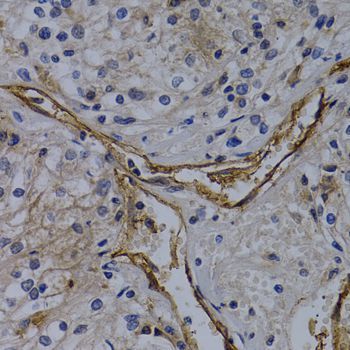 Immunohistochemistry - PECAM1 antibody (144-02104)