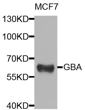 Western blot - GBA antibody (144-08420)