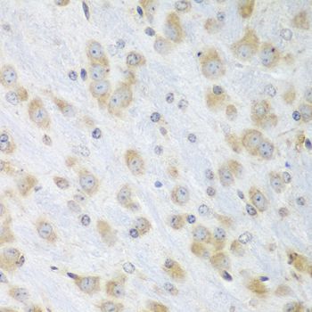 Immunohistochemistry - PDIA3 Polyclonal Antibody (144-01085)