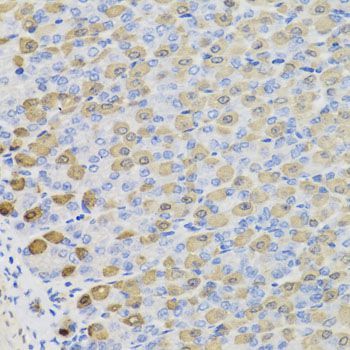 Immunohistochemistry - LDHB antibody (144-07625)