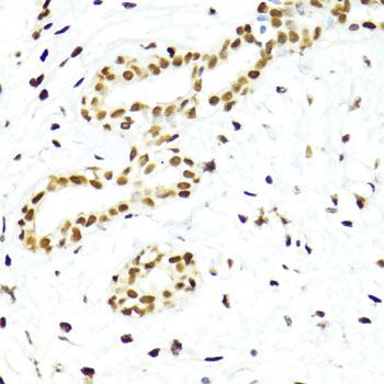 Immunohistochemistry - Phospho-Stat3-Y705 pAb (144-50070)
