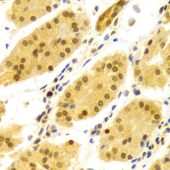 Immunohistochemistry - ELAVL1 Polyclonal Antibody (144-01608)