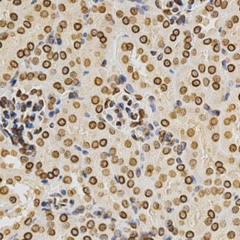 Immunohistochemistry - Lamin A/C Polyclonal Antibody (144-00249)